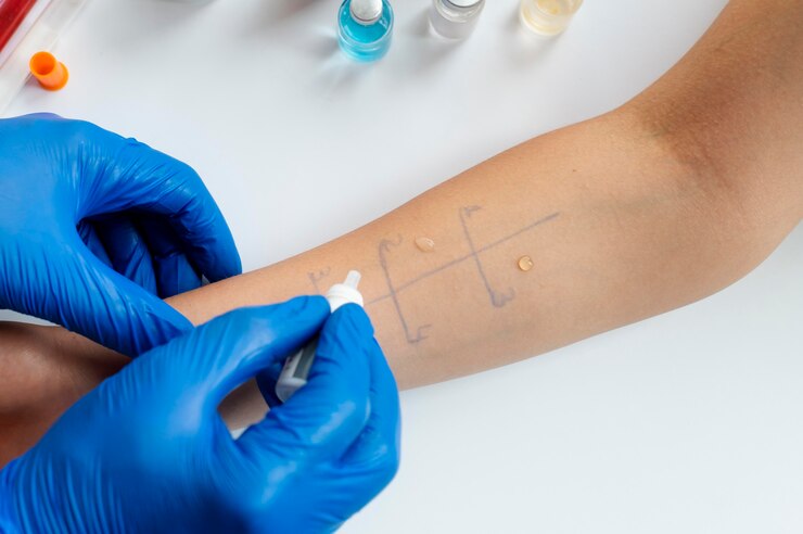 skin-allergy-reaction-test-person-s-arm_23-2149140456