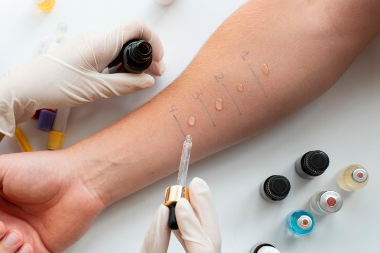 skin-allergy-reaction-test-person-s-arm_23-2149140458