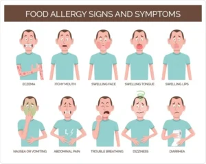 Food Allergy signs