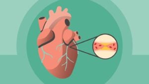 Heart Image